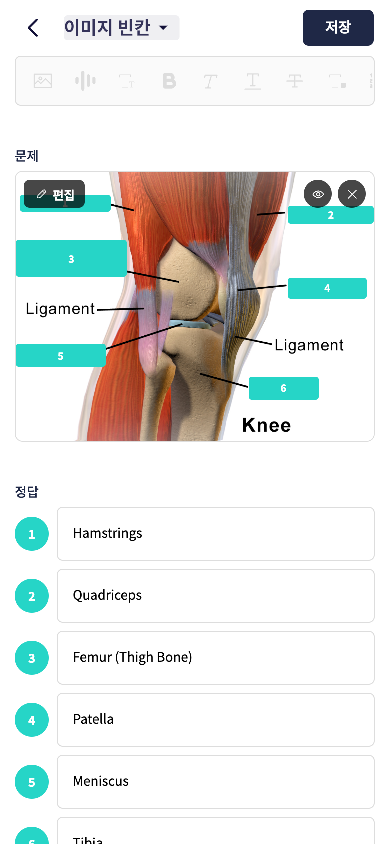 무릎 해부학 이미지 위에 라벨 가림막 만들기